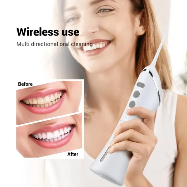 Irrigatore Orale Xiaomi Youpin – Flossing a Getto d’Acqua Elettrico, Sbiancamento Dentale, Ricarica USB, Cura delle Gengive, Design Portatile con 3 Modalità di Pulizia - immagine 5